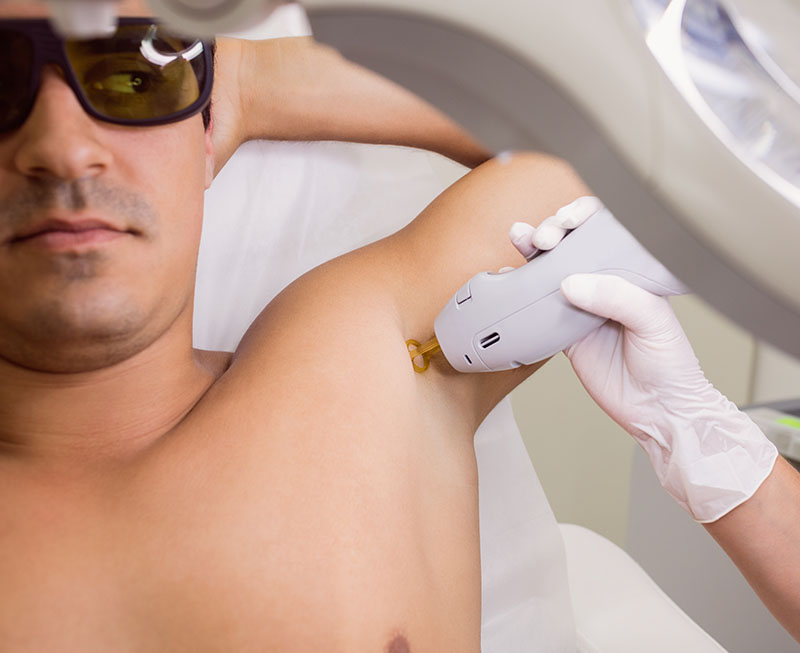 Лазерна епіляція, фото 2